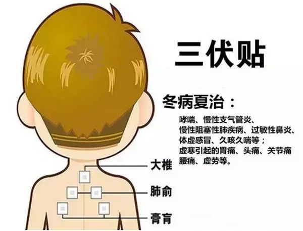 2、三伏貼的功能和功效是什么？